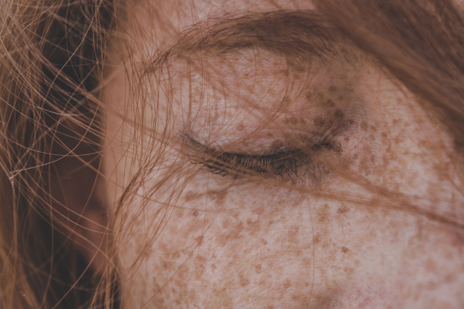 freckled skin red head